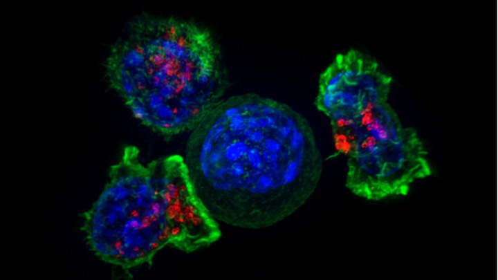 T-celler som d&ouml;dar cancercell