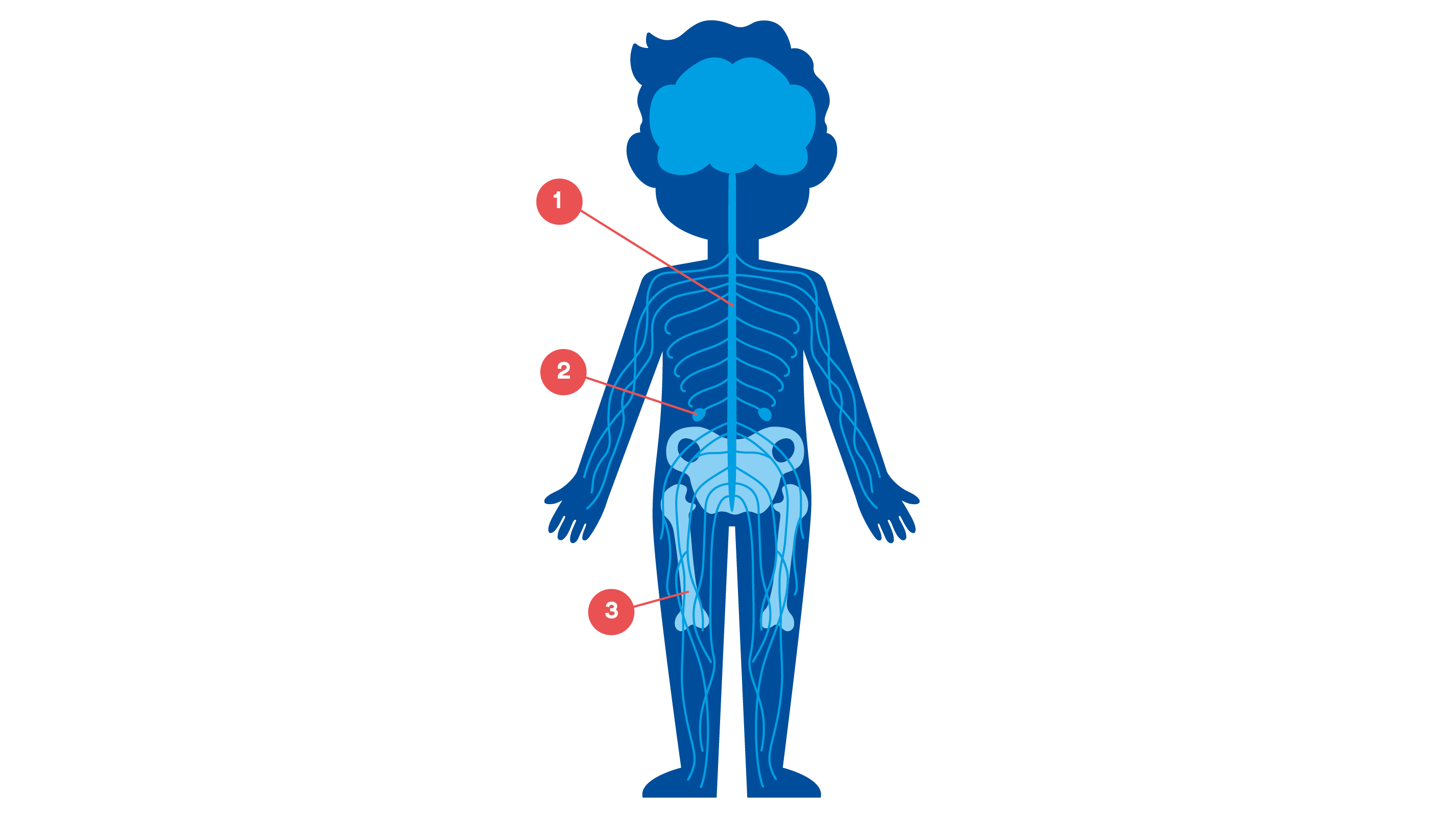 Illustration neuroblastom
