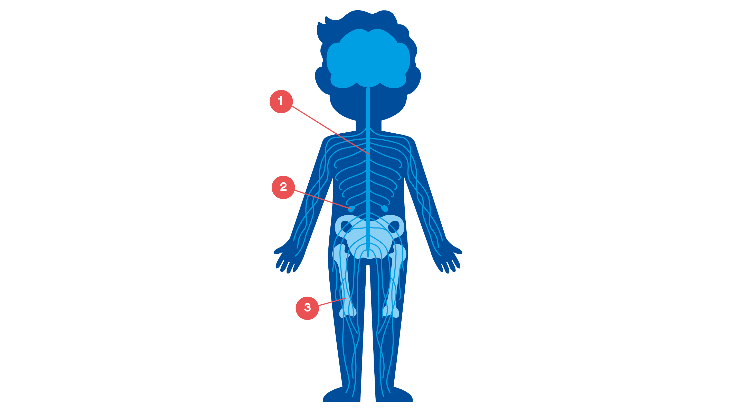 Illustration neuroblastom