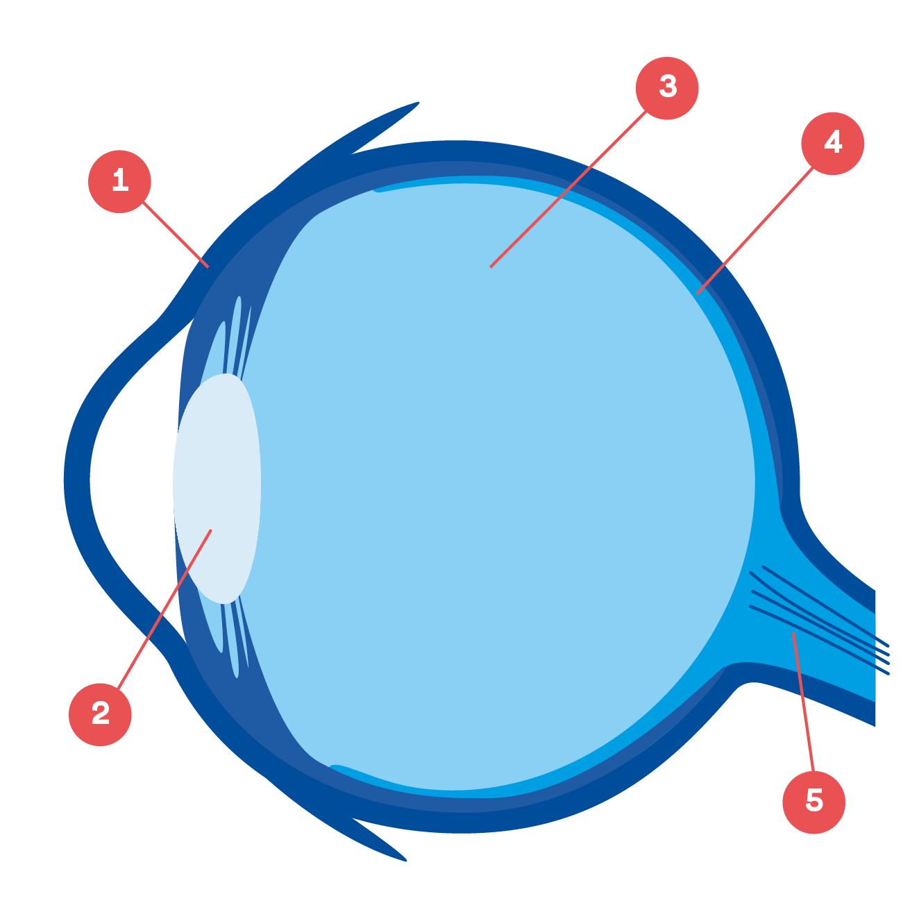 Illustration retinoblastom 